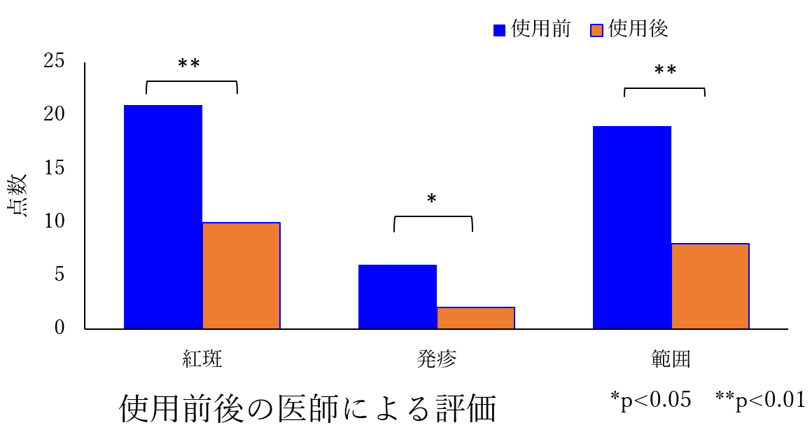 入浴液のおむつかぶれに対する改善効果　ニュースリリース：2009年