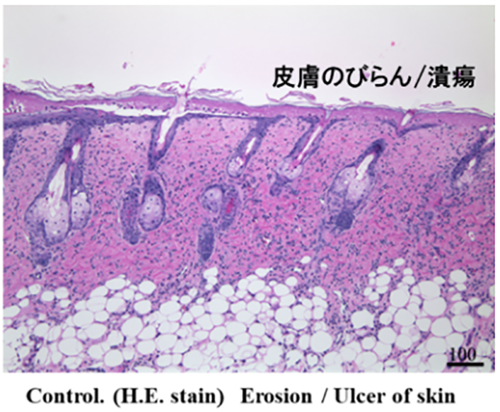 ハプテン(DNFB)反復塗布誘発掻痒モデル