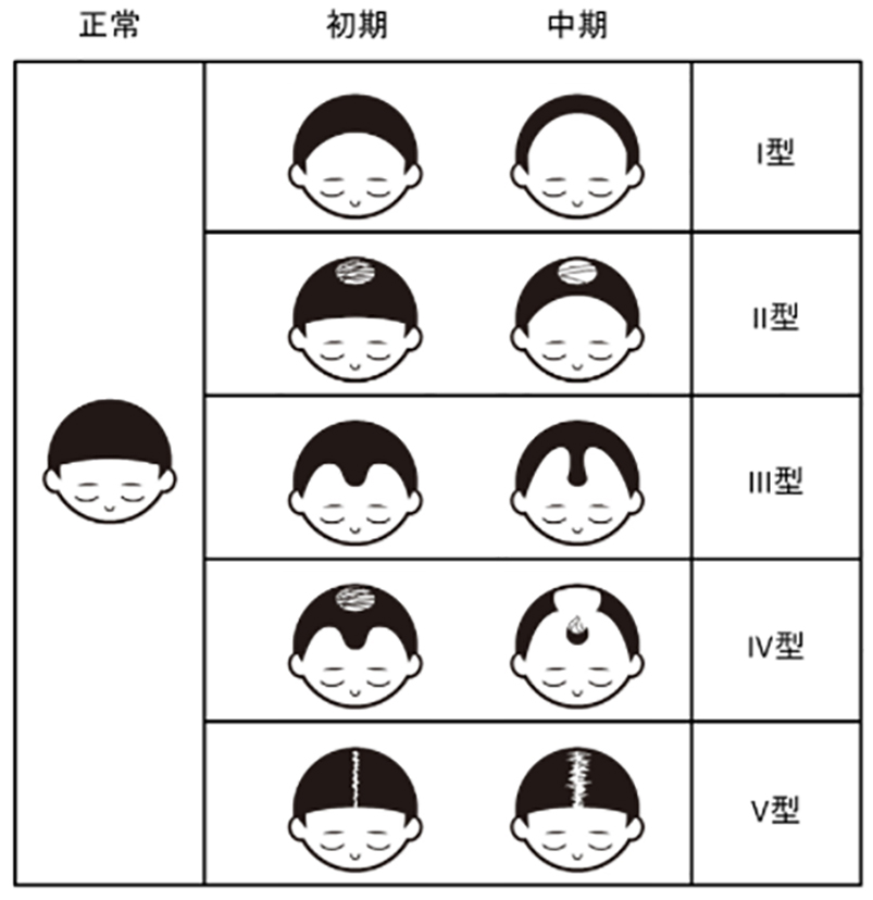 図１　緒方の分類